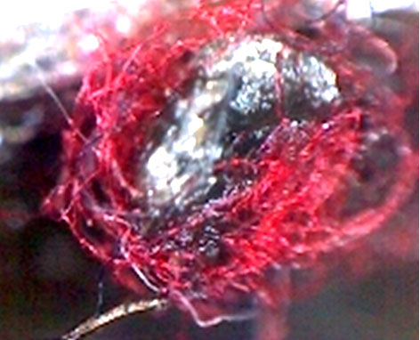 Фото 22. Запёкшиеся вещество красного цвета (вид через микроскоп – увеличение в 20 раз)