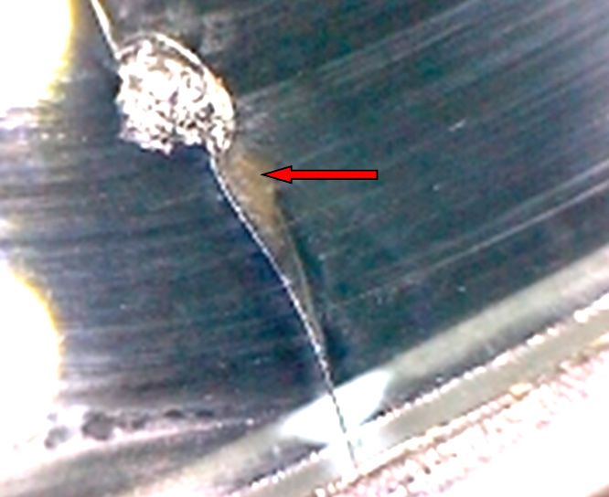 Фото 17. Скол и грязевые наложения (показаны красной стрелкой) – вид через микроскоп (увеличение в 10 раз).