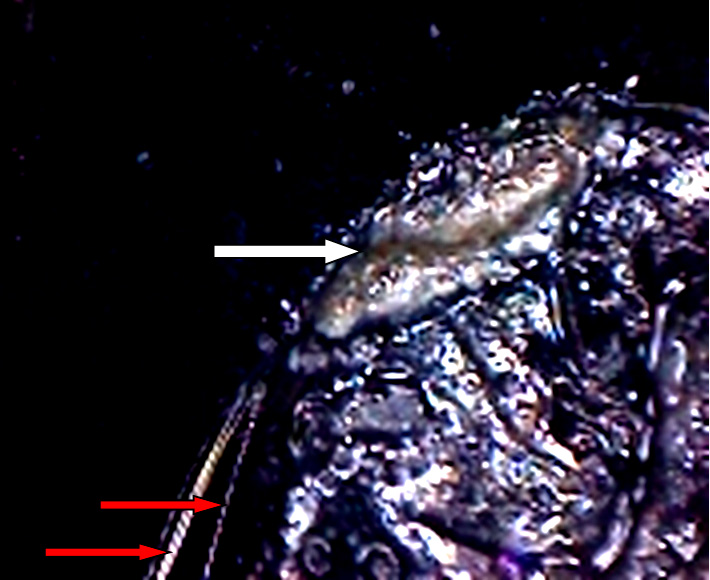 Фото 18. Очаг  зарождения скола в виде глубокого вдавленного следа с грязевыми наложениями внутри него (показан белой стрелкой) и трассы к данному следу (показаны красной стрелкой). Вид через микроскоп (увеличение в 30 раз).